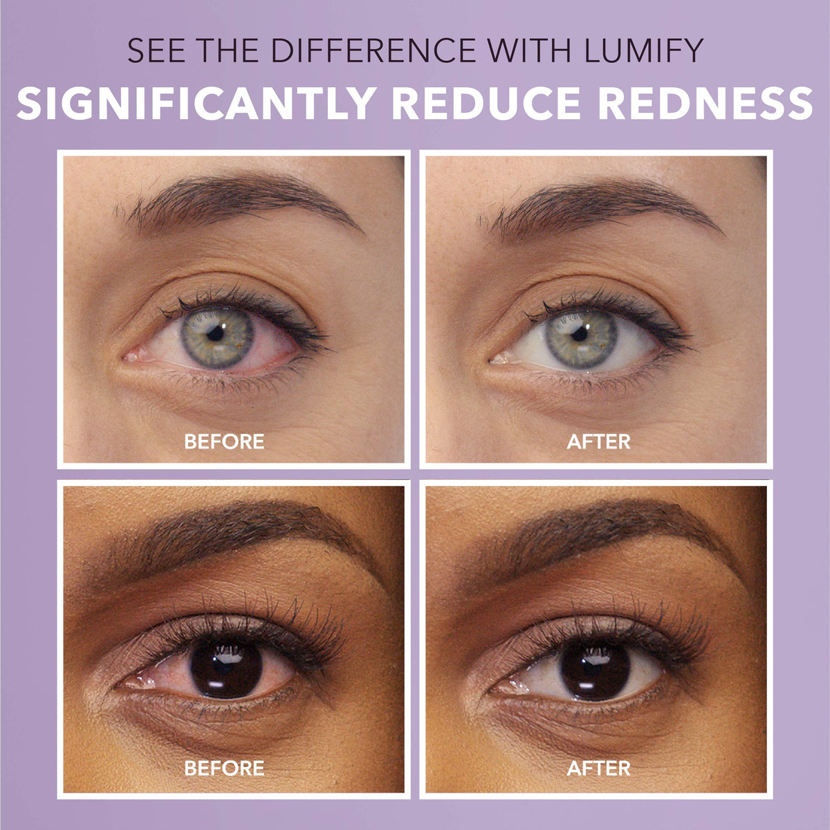 LUMIFY Eye Drops for Red Eyes, Redness Reliever for Brighter Looking Eyes, Works in 1 Minute & Lasts Up to 8 Hours, Eye Drops, 0.25 Fl Oz (7.5mL) LUMIFY buy supplements Au