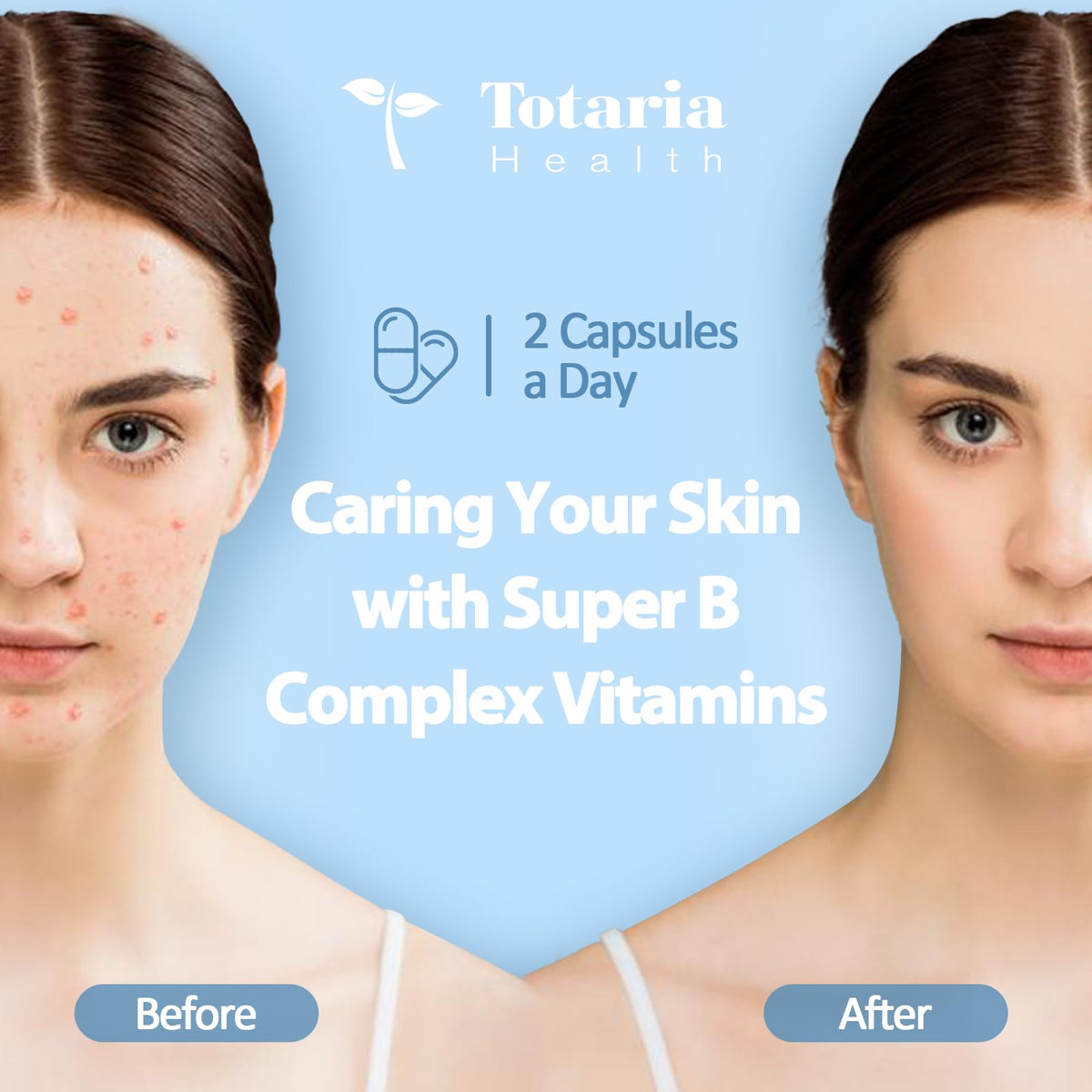 13-in-1 Vitamin B Complex Plus with Vitamin B1, B2, B3 (Niacinamide), B4, B5, B6, B7 (Biotin), B8 (Inositol), B9 (Folate), B12, C, D3, K2 - Energy, Nerve, - PrimeBioHealth - canada supplements
