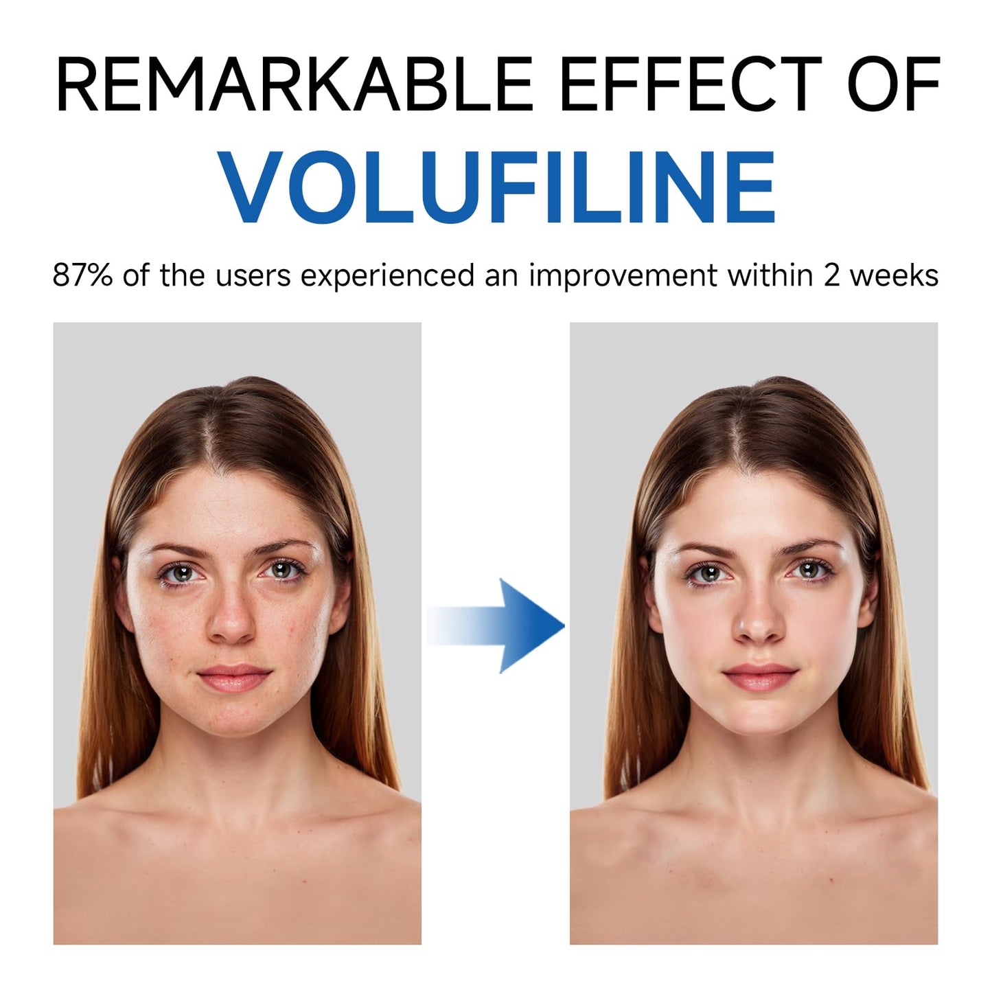 Volufiline Serum, Volufiline Under Eye Serum, Cosmetic Grade Ampoule for Skin Elasticity Improvement, Face & Body Fine Lines, Hydrating Texture, 10ml*2 GUDE GUDEBuy Supplements Australia