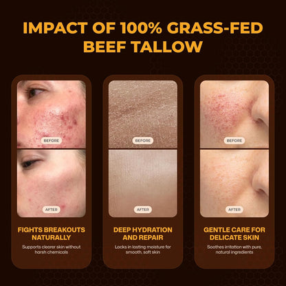 VIORY Tallow and Honey Balm for Face, Beef Tallow for Skin, Moisturizer | With 100% Organic Grass-Fed Beef Tallow & Raw Wild Honey, Natural Formula For Dry & Sensitive Skin (Unscented)