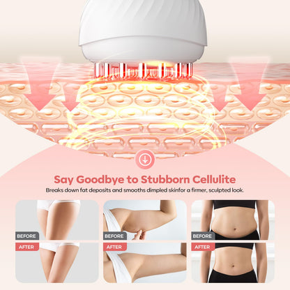 HarrFlow Lymphatic Drainage Massager & Anti Cellulite Massage Tool, Lymphatic Massager,Helps Reduce Stretch Marks & Cellulite，for Belly, Arms & Legs,Body Sculpting Machine with Heat & Vibration HarrFlow buy supplements Au