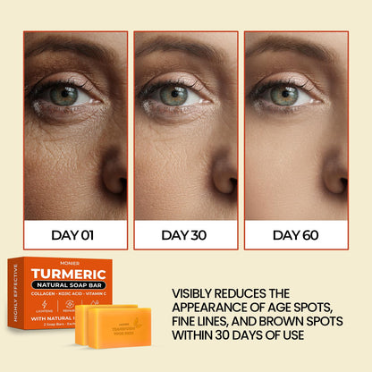 MONIER Turmeric Soap Bar for Dark Spots - With Kojic Acid & Collagen | With Kojic Acid, Collagen, Coconut Oil, Vitamin C, Vitamin E, Moisturizing & Nourishing, Natural (2 Soap Bars + Storage Net)
