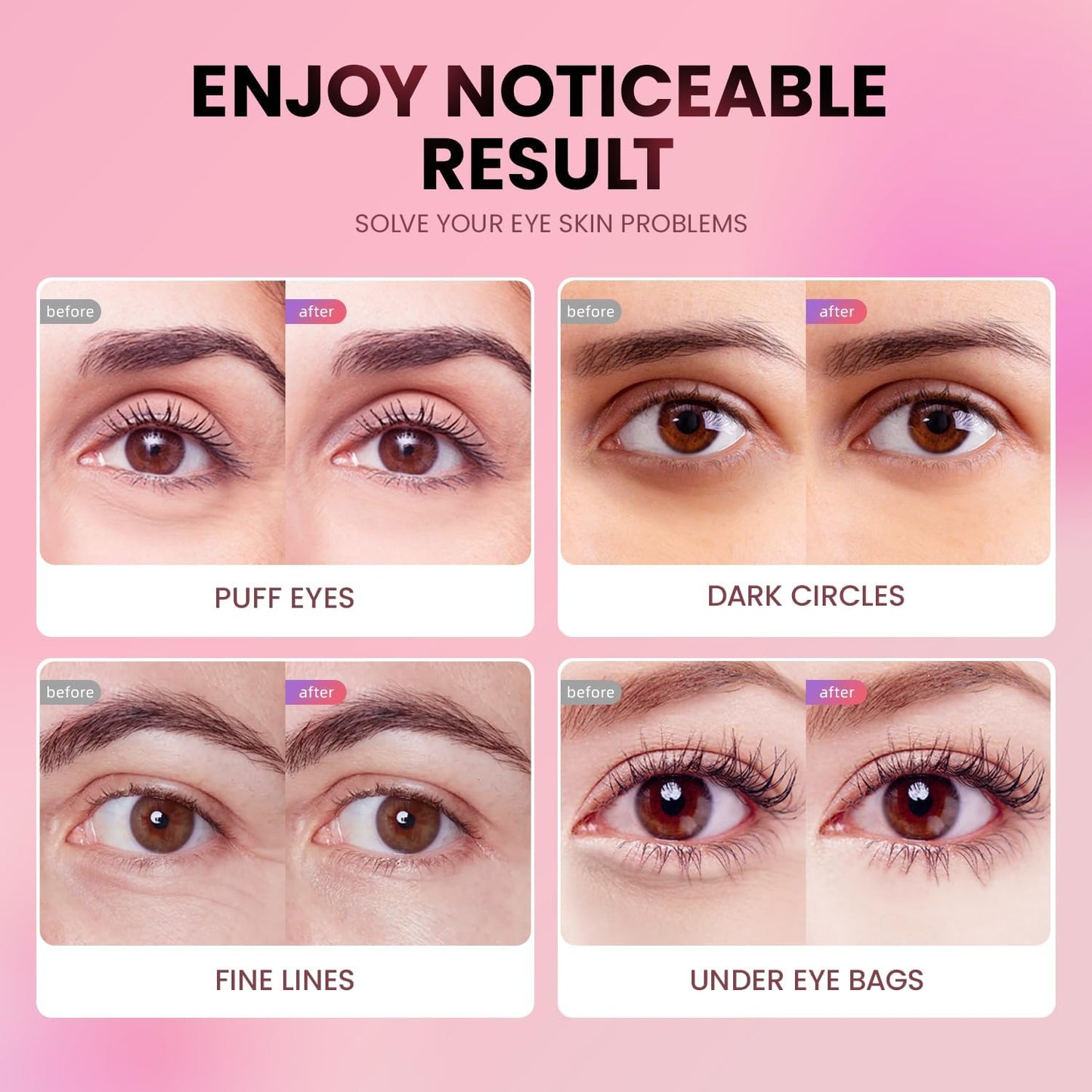 AILEORY Under Eye Patches (24 Pairs) - Tri-color Glitter Eye Gel Pads for Dark Circles, Puffy Eyes, Under eye Bags, Wrinkles - PrimeBioHealth - canada supplements