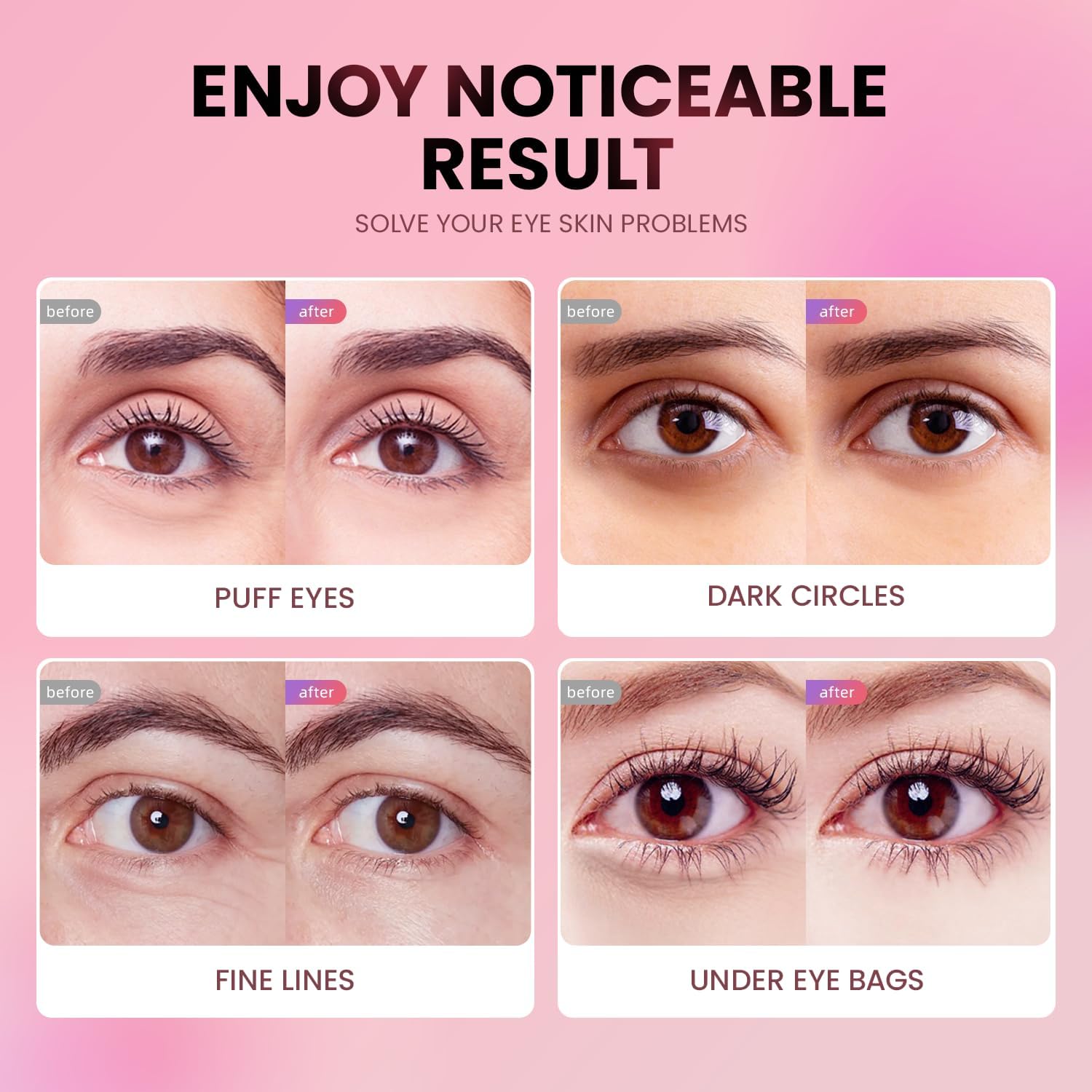 AILEORY Under Eye Patches (24 Pairs) - Tri-color Glitter Eye Gel Pads for Dark Circles, Puffy Eyes, Under eye Bags, Wrinkles - PrimeBioHealth - canada supplements