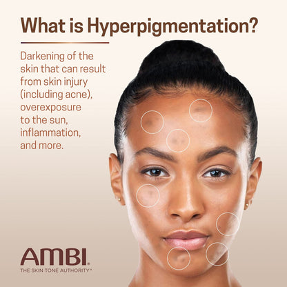 Ambi Even & Clear Advanced Fade Cream, Hydroquinone-free, Hyperpigmentation Treatment, Stubborn Dark Spot Corrector, Results In As Little As 2-3 Weeks - PrimeBioHealth - canada supplements