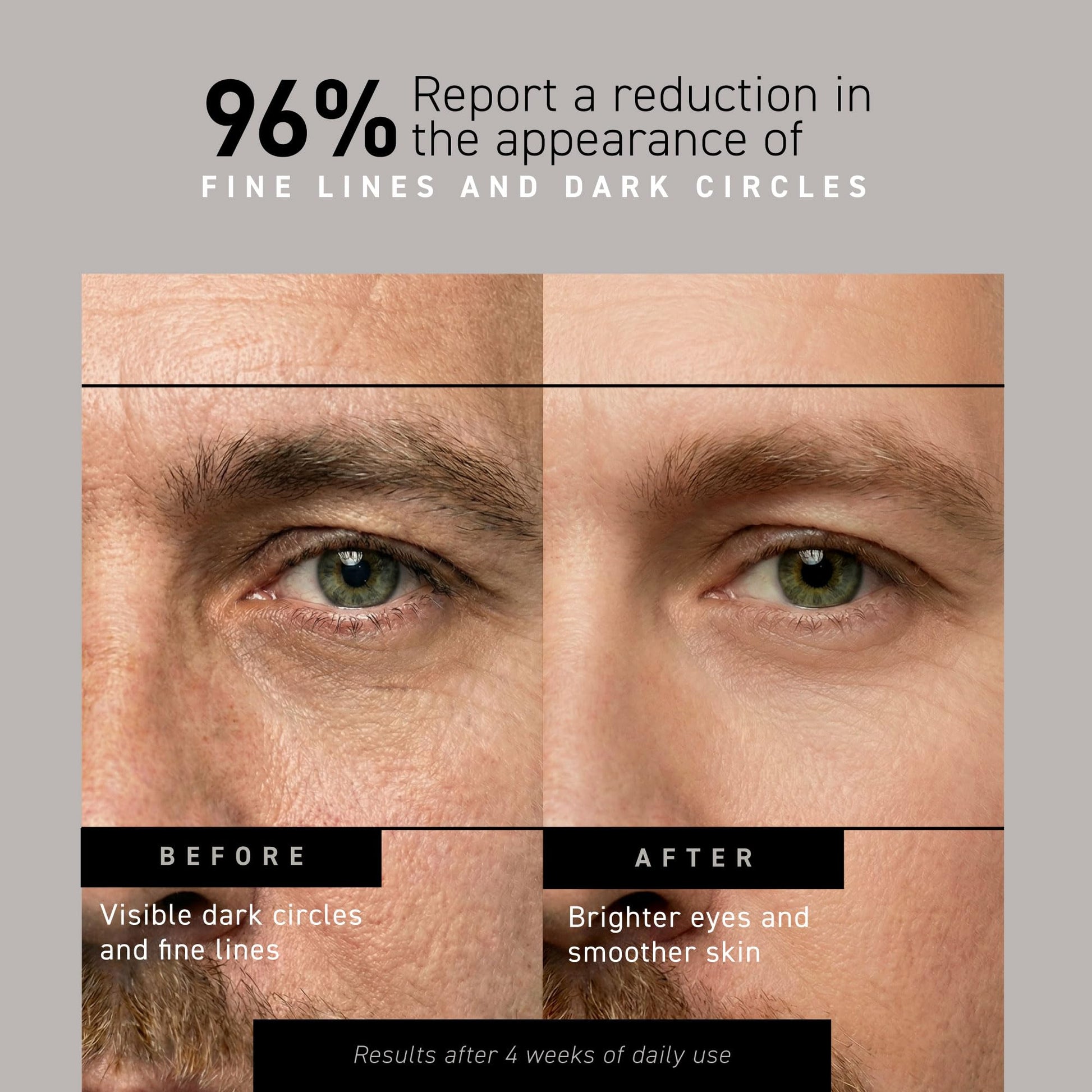 Brickell Men's Restoring Under Eye Cream for Men, Natural and Organic Anti Aging Eye Balm To Reduce Puffiness, Wrinkles, Dark Circles - PrimeBioHealth - canada supplements