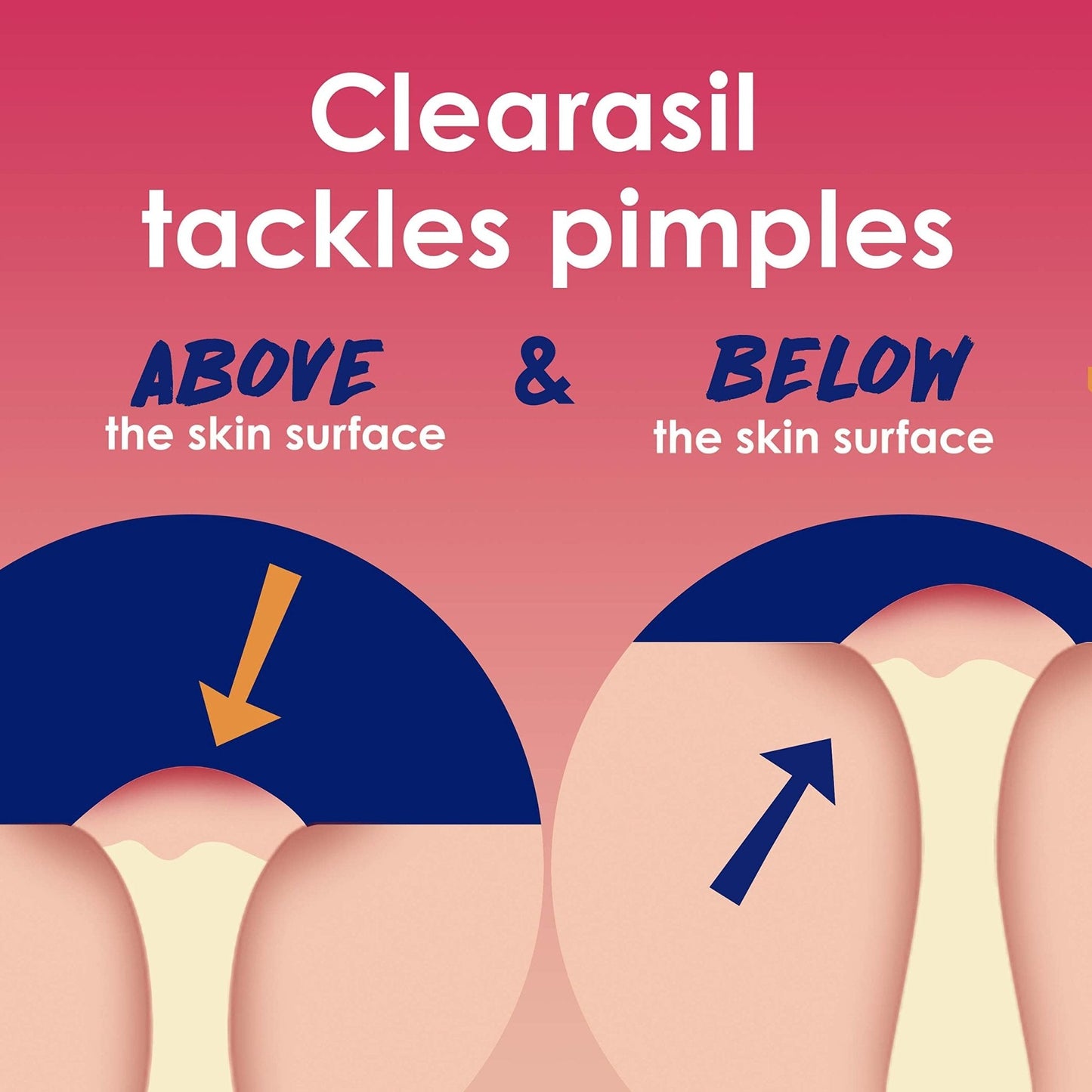 Clearasil Rapid Rescue Deep Treatment Acne Face Pads, Maximum Strenght with 2% Salicylic Acid Acne - PrimeBioHealth - canada supplements