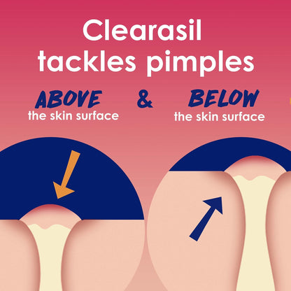Clearasil Rapid Rescue Deep Treatment Acne Face Pads, Maximum Strenght with 2% Salicylic Acid Acne - PrimeBioHealth - canada supplements