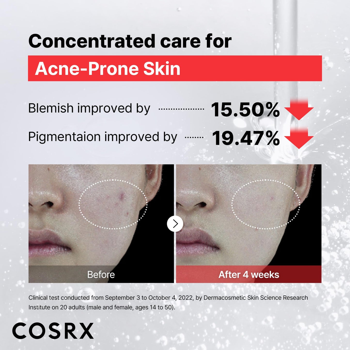COSRX 15% Niacinamide Face Serum, 0.67 fl oz, Pore Minimizer Serum for Face, Even Skin Tone, Korean Skin Care - PrimeBioHealth - canada supplements
