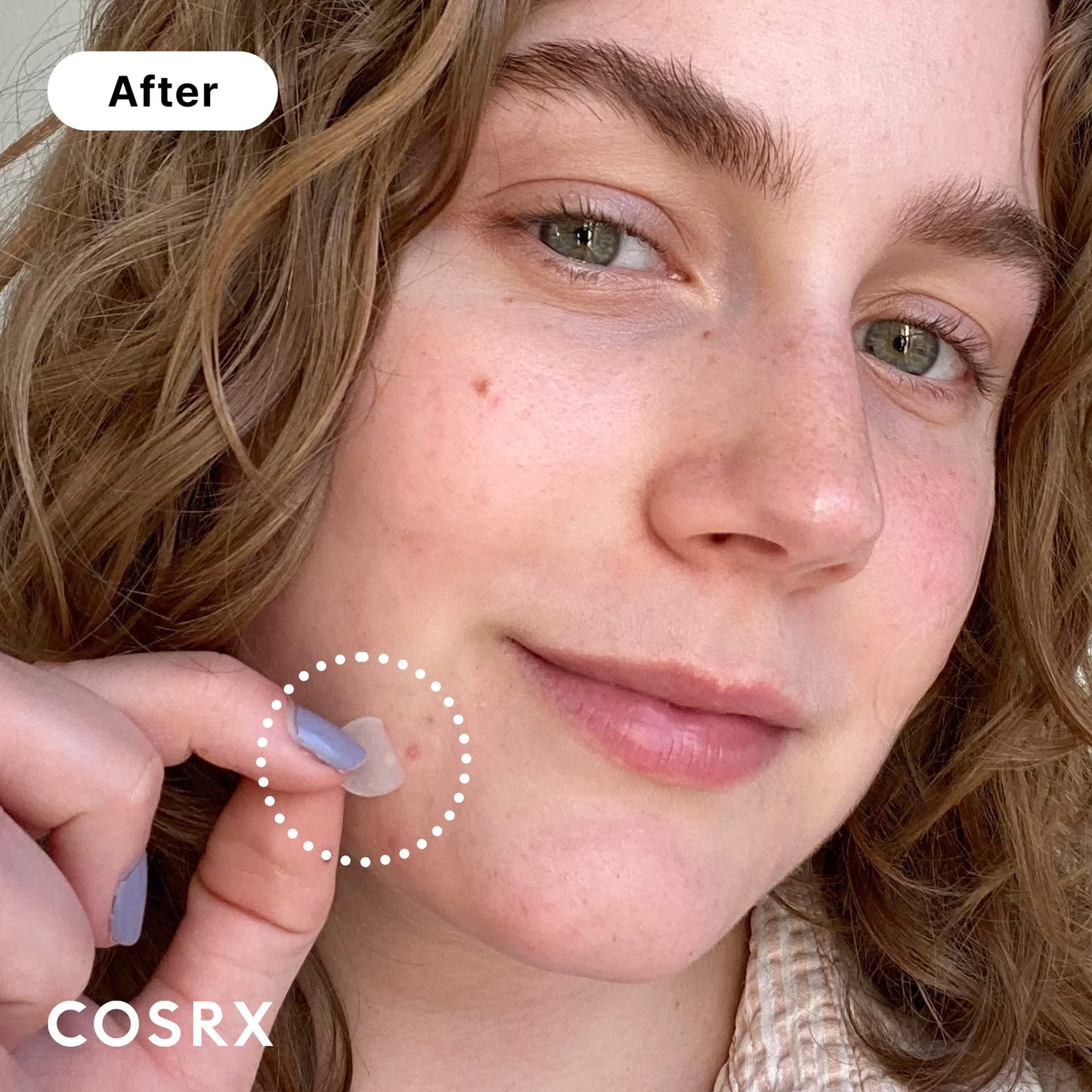 COSRX Acne Pimple Patch (96) Absorbing Hydrocolloid Original 3 Size Patches for Blemishes and Zits Cover - PrimeBioHealth - canada supplements