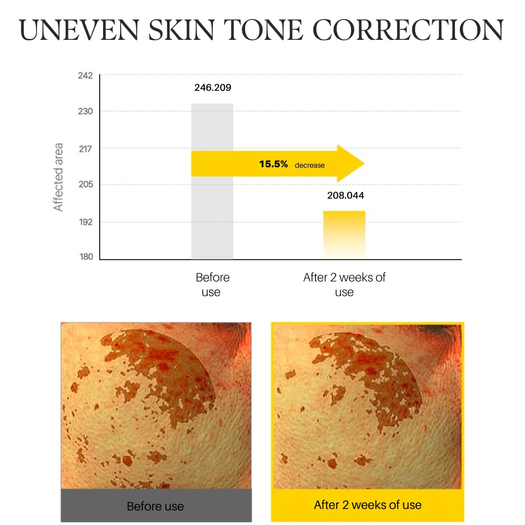 d'alba Piedmont White Truffle Vita Toning Serum Toner, Glass Skin with Double Vitamin Skincare, Face Moisturizer, (6.09 fl. oz) - PrimeBioHealth - canada supplements