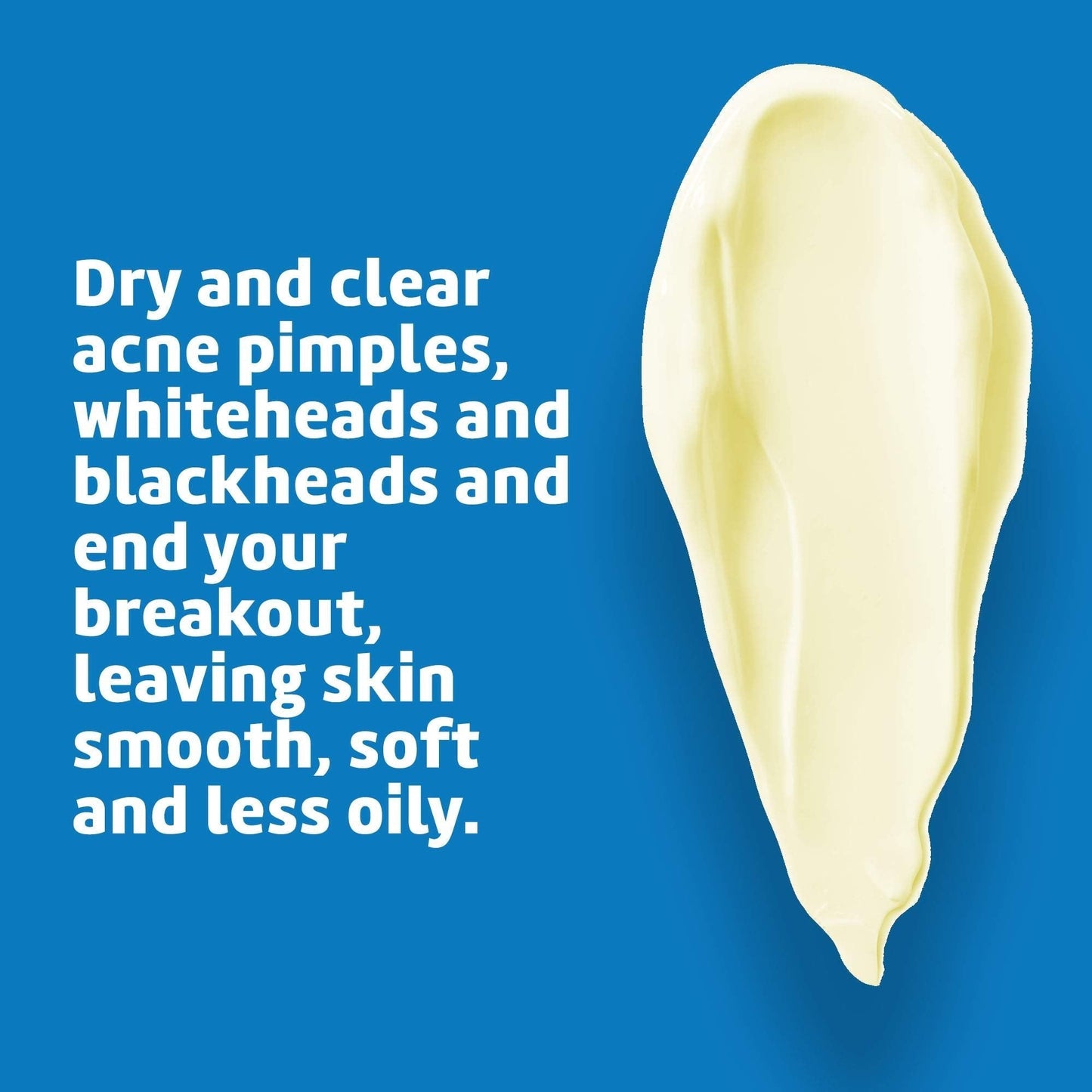 De La Cruz Sulfur Ointment - Cystic Acne Treatment for Face and Body - Daily 10 Min Spot Treatment Mask - Safe and Effective Game Changing Hormonal Acne - PrimeBioHealth - canada supplements