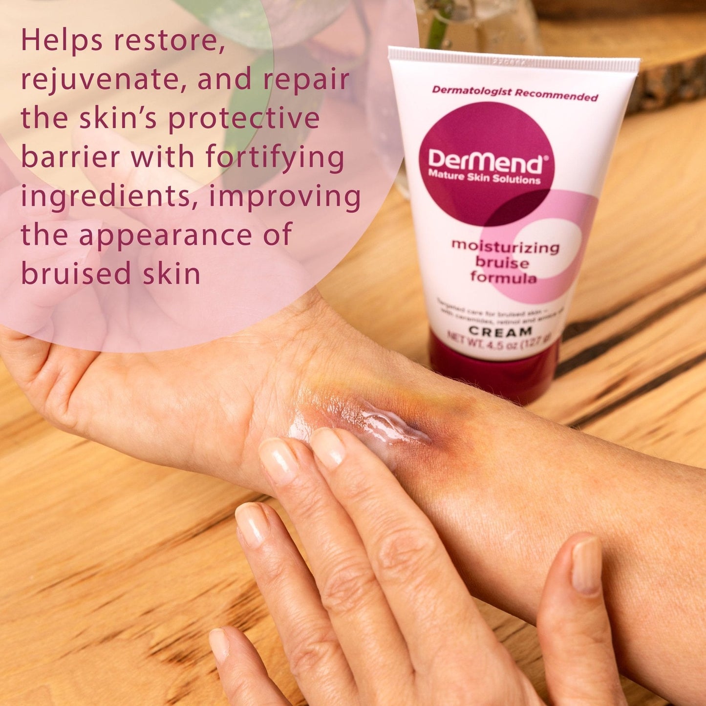 Dermend Arnica Bruise Cream with Vitamin K - Moisturizer for Bruising on Arms, Legs & Hands - 4.5 Oz - PrimeBioHealth - canada supplements
