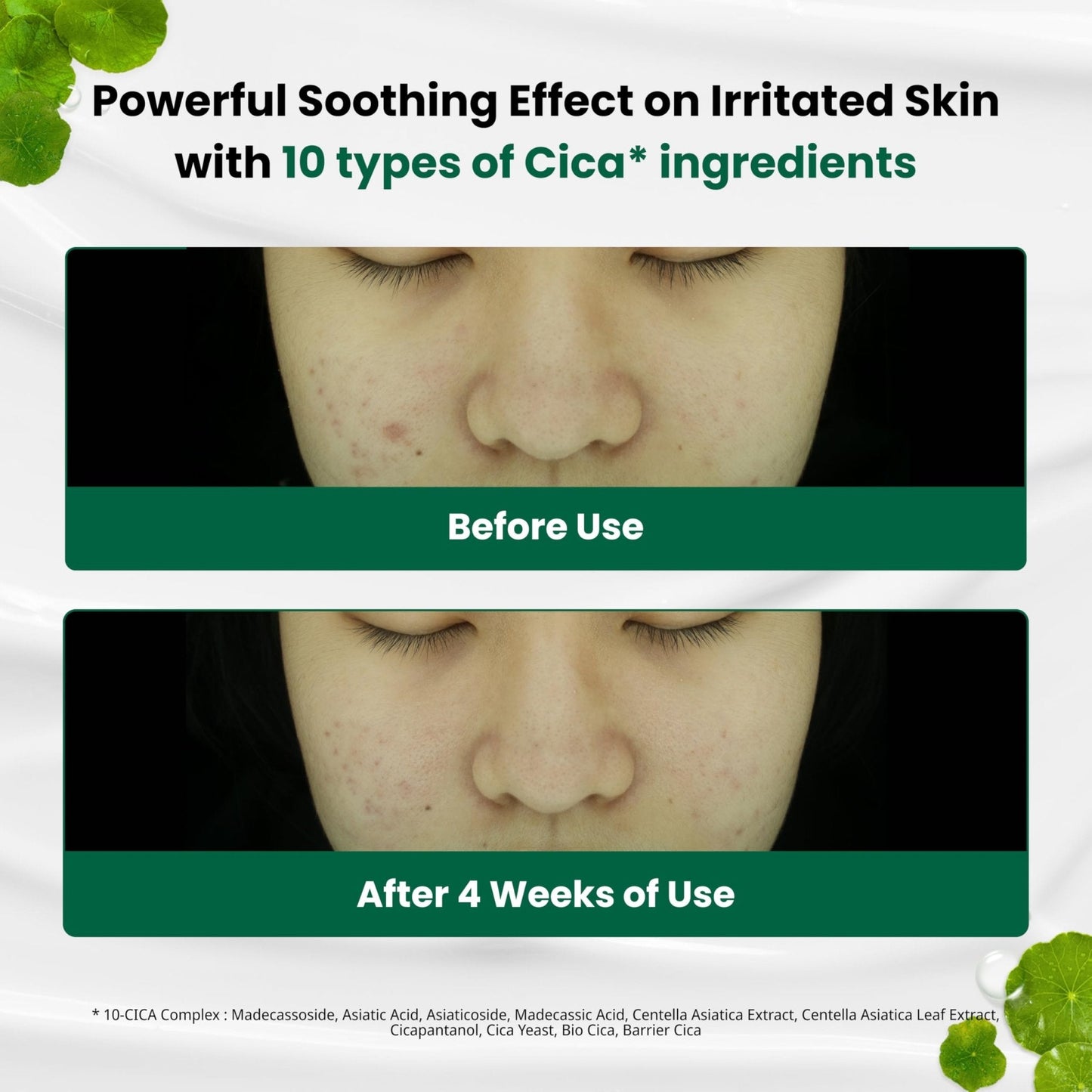 Dr. G R.E.D. Blemish Clear Soothing Cream - Calming Korean Moisturizer for Redness - Soothes Acne & Irritation - PrimeBioHealth - canada supplements