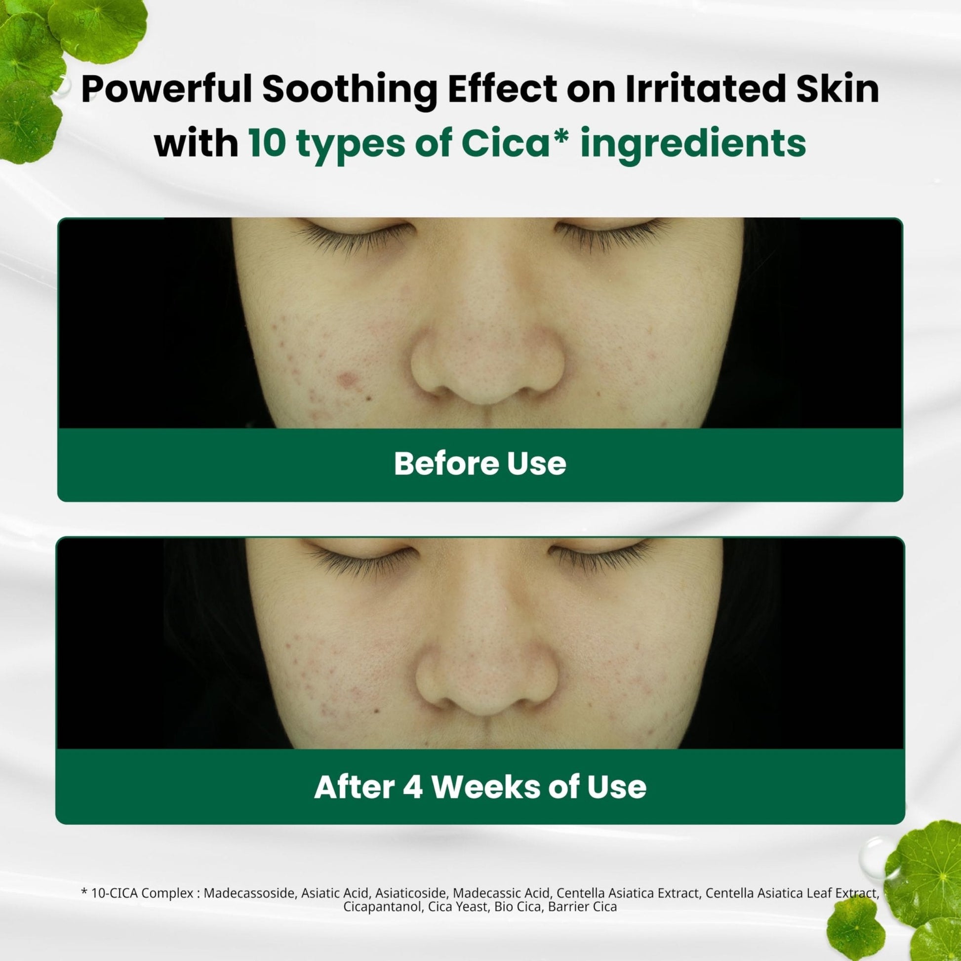 Dr. G R.E.D. Blemish Clear Soothing Cream - Calming Korean Moisturizer for Redness - Soothes Acne & Irritation - PrimeBioHealth - canada supplements