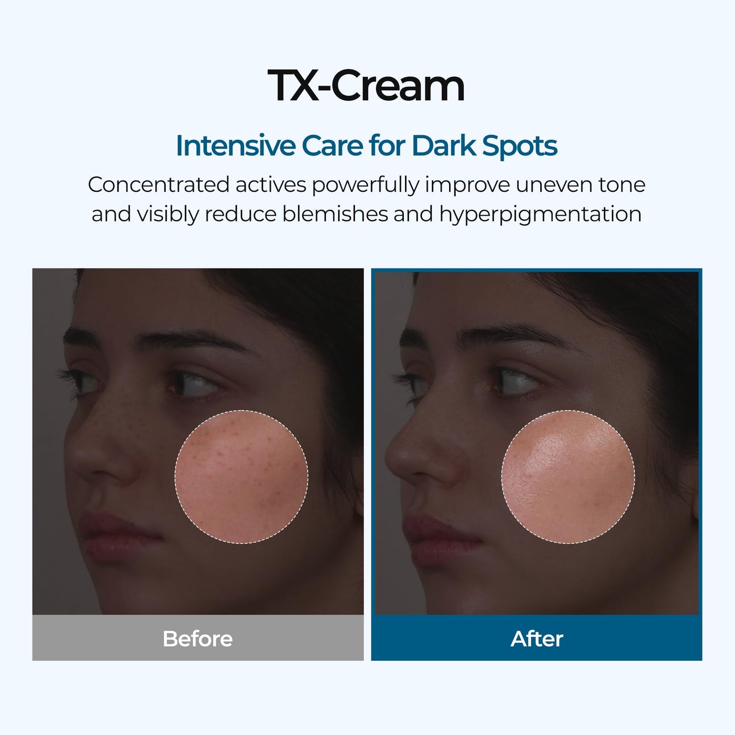 DR.Melaxin TX Tranexamic Acid CREAM | Skin freckle Cream, Blemishes, Anti-pigmetation korean skin care - PrimeBioHealth - canada supplements