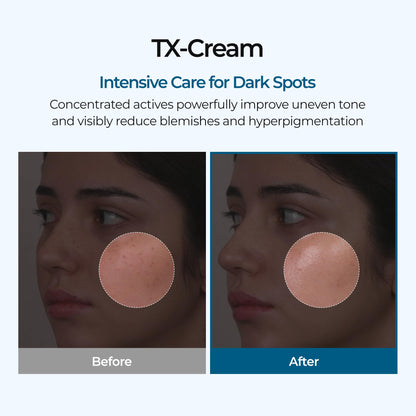 DR.Melaxin TX Tranexamic Acid CREAM | Skin freckle Cream, Blemishes, Anti-pigmetation korean skin care - PrimeBioHealth - canada supplements