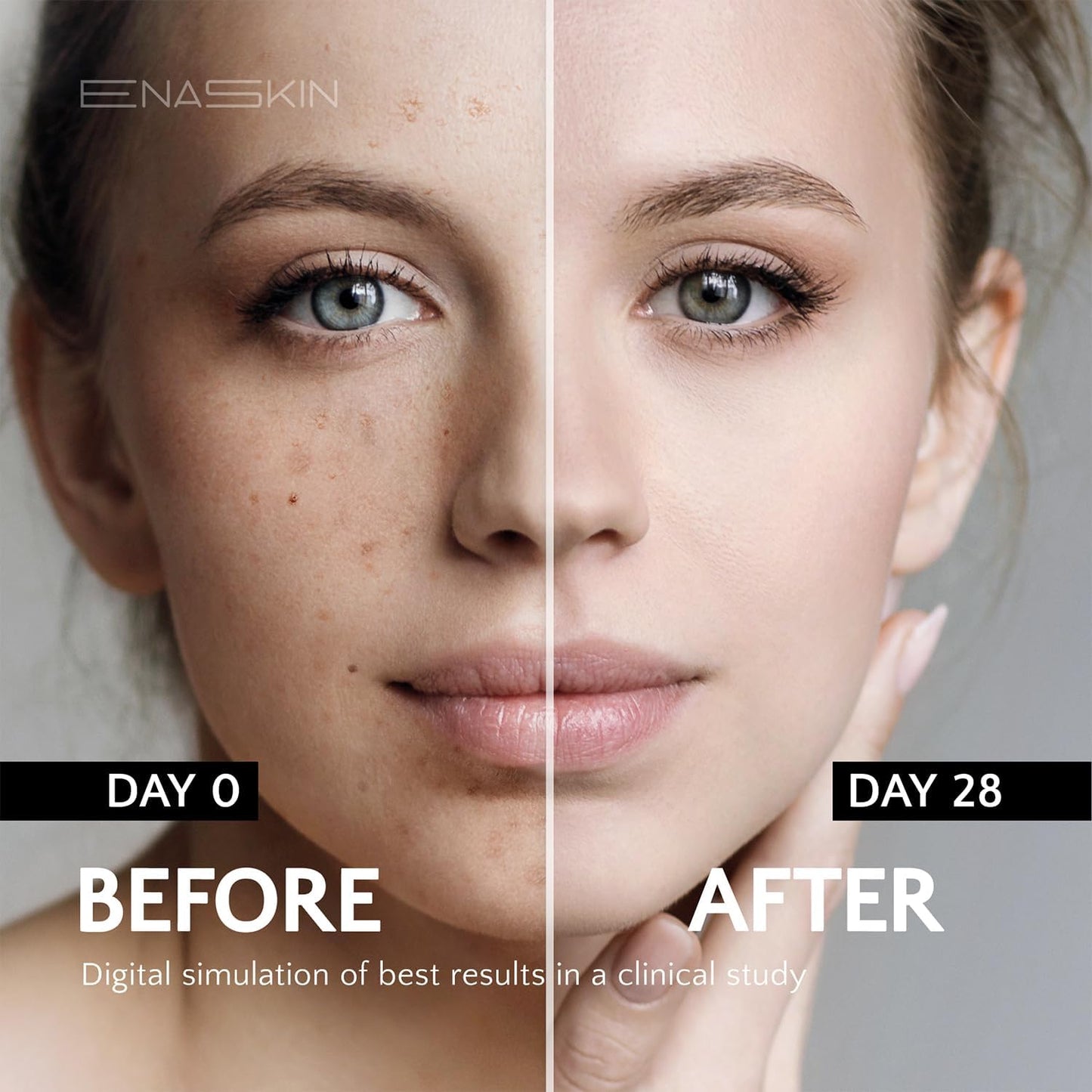 Enaskin Dark Spot Set - Serum & Soap Bars: Hyperpigmentation Body Treatment for Freckles Melasma Age Spot Sun Spot - Dark Spots Corrector Serum - PrimeBioHealth - canada supplements