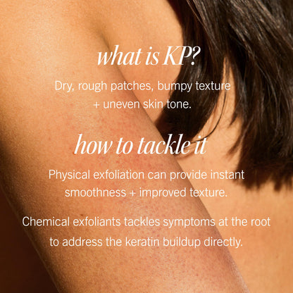 First Aid Beauty - KP Bump Eraser Body Scrub with 10% AHA, Keratosis Pilaris Exfoliator with Glycolic and Lactic acids, Helps Reduce Chicken Skin Bumps - PrimeBioHealth - canada supplements
