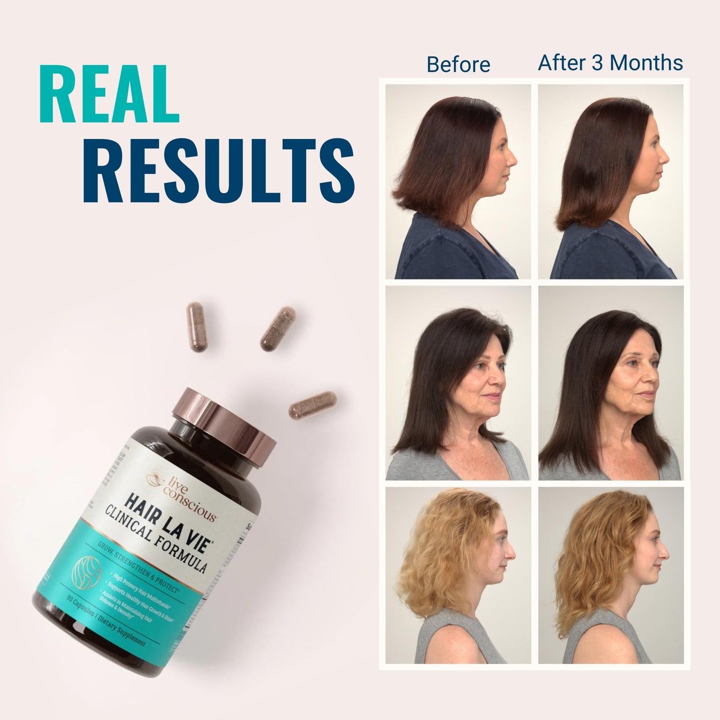 Hair La Vie Live Conscious Clinical Formula Hair Growth Vitamins for Women and Men w/Biotin, Collagen & Saw Palmetto (Pack of 1) - PrimeBioHealth - canada supplements