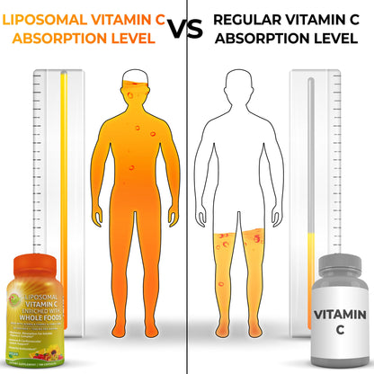 Liposomal Vitamin C Capsules - 1500mg - Made with Organic Acerola Cherries & Camu Camu, High Potency Vitamin C Liposomal - Immune Support Supplement - PrimeBioHealth - canada supplements