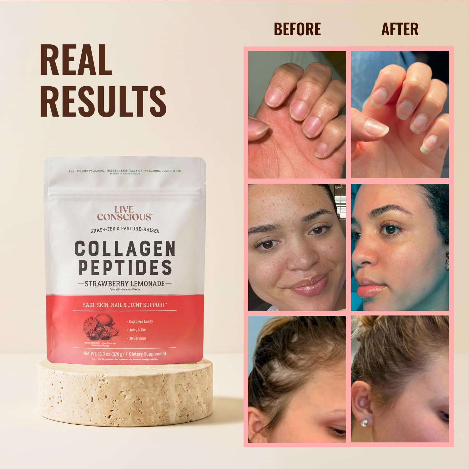 Live Conscious Collagen Peptides Powder - Naturally-Sourced Hydrolyzed Collagen Powder - Hair, Skin, Nail, and Joint Support - Type I & III Grass-Fed Collagen Supplements for Women and Men - 16oz - PrimeBioHealth - canada supplements