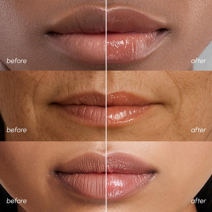 MAREE Lip Mask Overnight - Lip Moisturizer For Very Dry Lips - Hydrating Lip Butter Balm with Hyaluronic Acid & Collagen - PrimeBioHealth - canada supplements