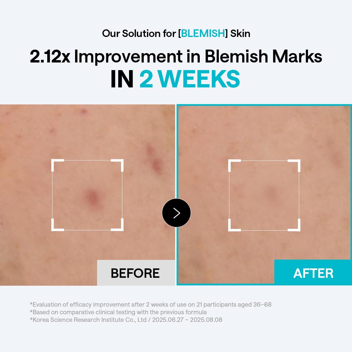 MEDIHEAL Toner Pads 100 Count - Madecassoside Blemish Care Toner Pad with Centella Asiatica - Improves Uneven Skin Tone & Deep Hydration - PrimeBioHealth - canada supplements