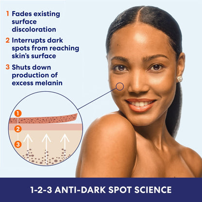 Palmer's Skin Success Anti-Dark Spot Fade Milk Body Lotion, 8.5 Ounce - PrimeBioHealth - canada supplements