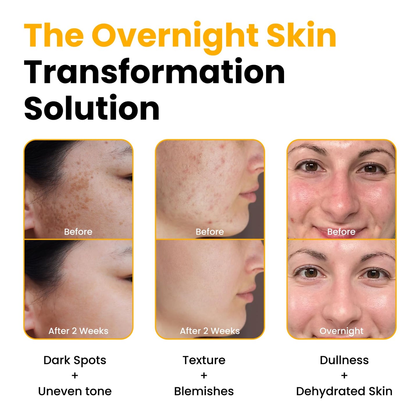 QUIA Turmeric + Kojic Acid Overnight Wrapping Mask – Hydration Mask for Glowing Skin - PrimeBioHealth - canada supplements