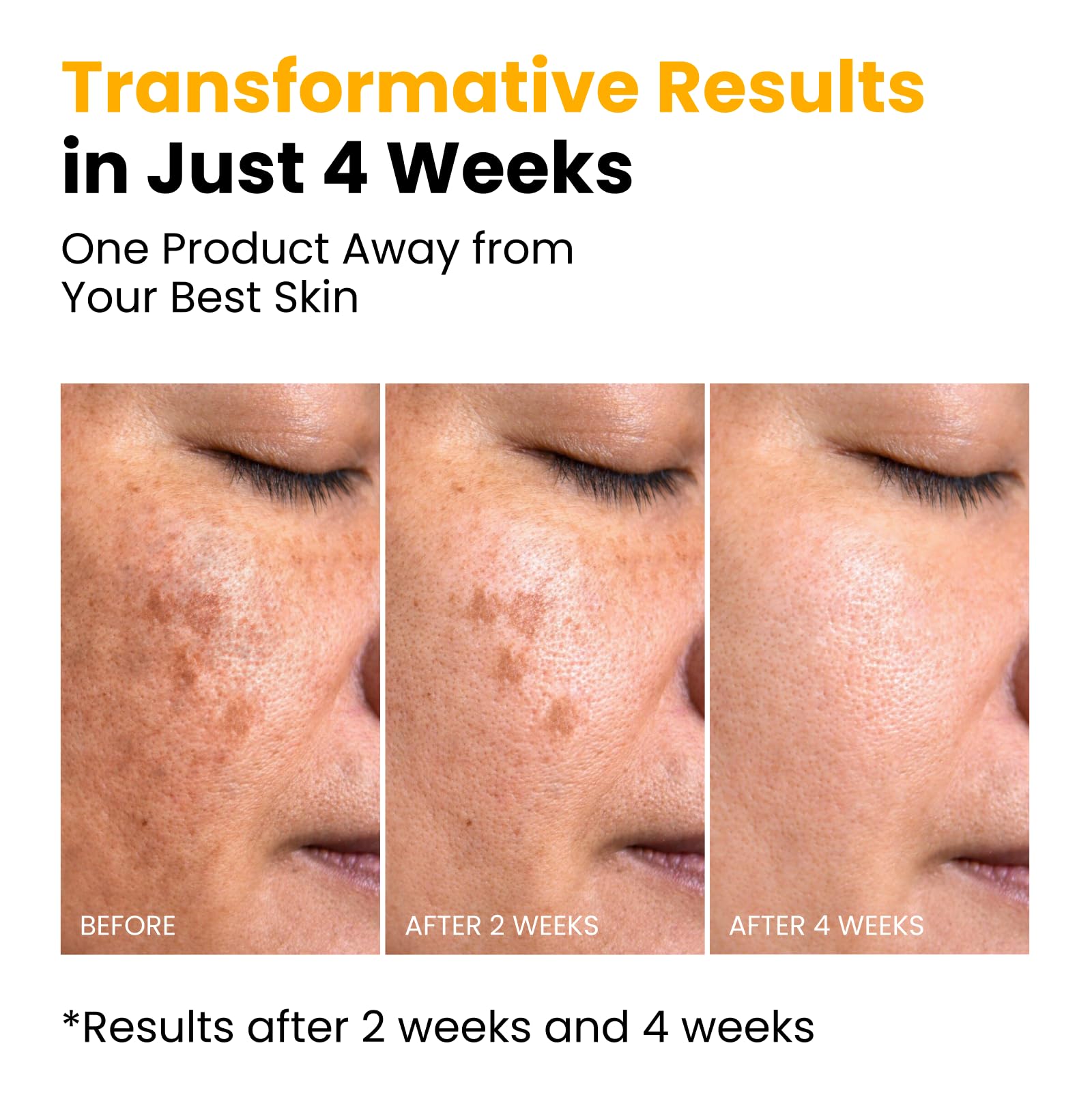 QUIA Turmeric + Kojic Acid Overnight Wrapping Mask – Hydration Mask for Glowing Skin - PrimeBioHealth - canada supplements