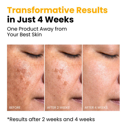 QUIA Turmeric + Kojic Acid Overnight Wrapping Mask – Hydration Mask for Glowing Skin - PrimeBioHealth - canada supplements