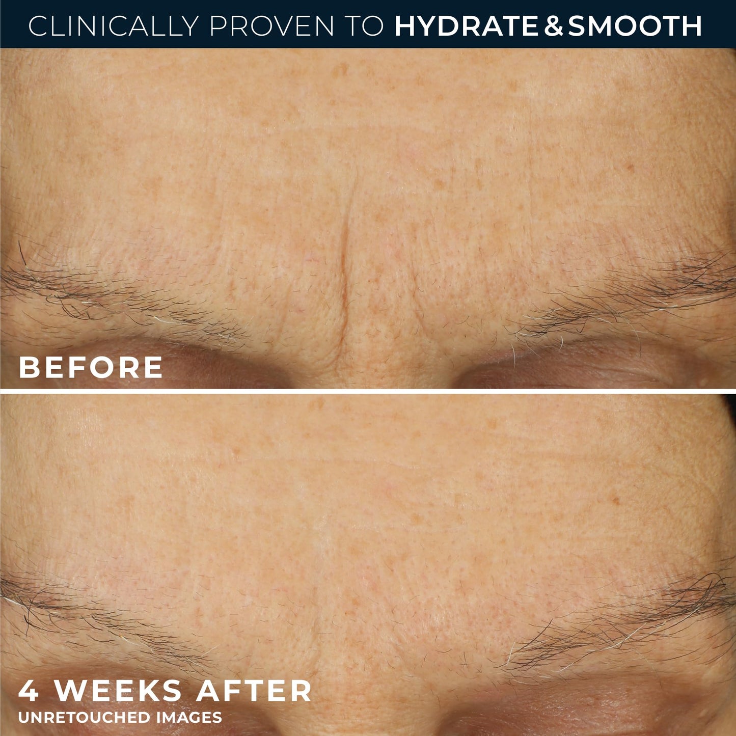 RoC Retinol Correxion Max Daily Hydration Anti-Aging Face Moisturizer with Hyaluronic Acid - PrimeBioHealth - canada supplements