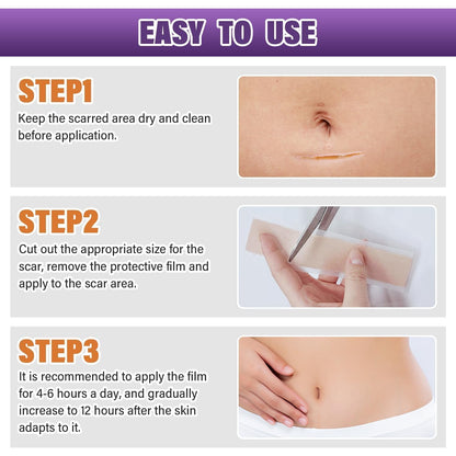 Silicone Scar Sheets,Silicone Scar Tape,Silicone Scar Removal Strips for Surgical,C-Section,Tummy Tuck,Keloid Scars - PrimeBioHealth - canada supplements
