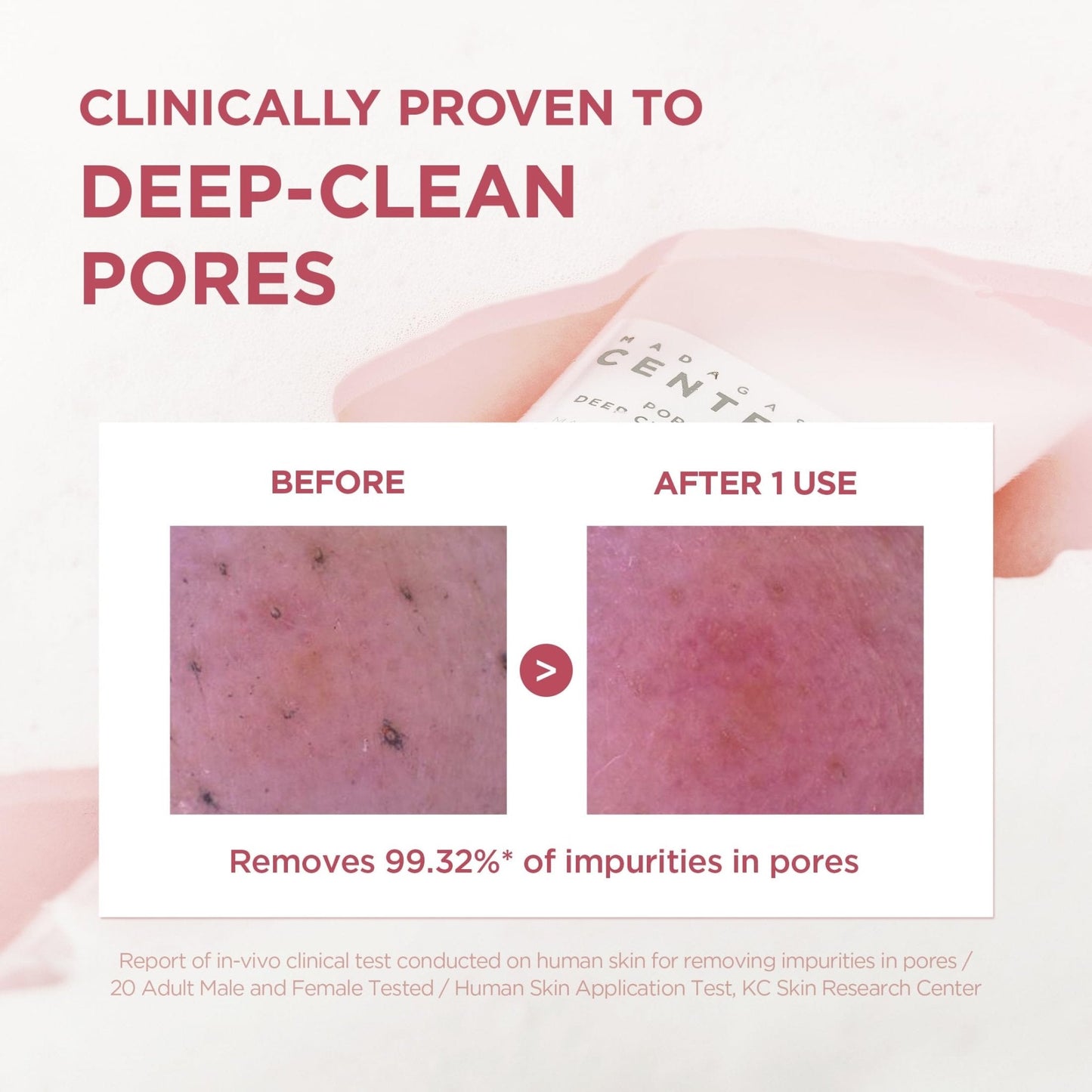 SKIN1004 Poremizing Deep Cleansing Foam, 4.23 fl.oz, 125ml, Makeup Remover, Korean Face Cleanser with Himalayan Pink Salt - PrimeBioHealth - canada supplements