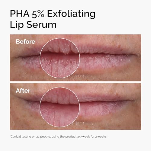 The Ordinary PHA 5% Exfoliating Lip Serum, Hydrating Overnight Lip Exfoliator Treatment, 0.5 Fl Oz - PrimeBioHealth - canada supplements