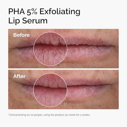 The Ordinary PHA 5% Exfoliating Lip Serum, Hydrating Overnight Lip Exfoliator Treatment, 0.5 Fl Oz - PrimeBioHealth - canada supplements