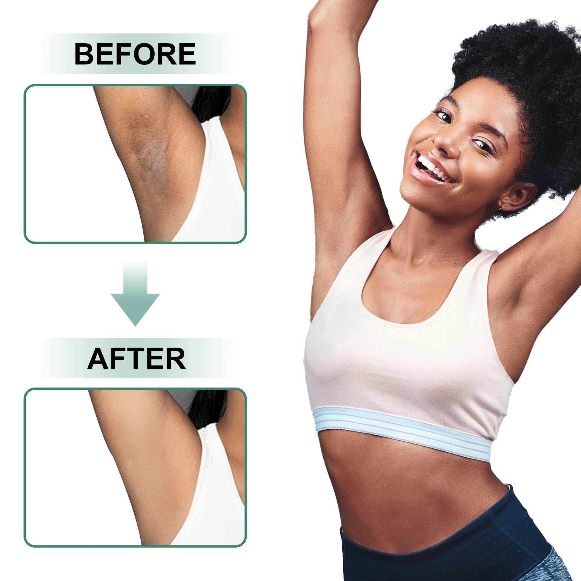 Vcetree Skin Bleaching Cream Skin Lightening for Body Intimate Areas, Private Parts, Underarm, Knees, Elbows, Inner Thigh, Bikini Area - PrimeBioHealth - canada supplements