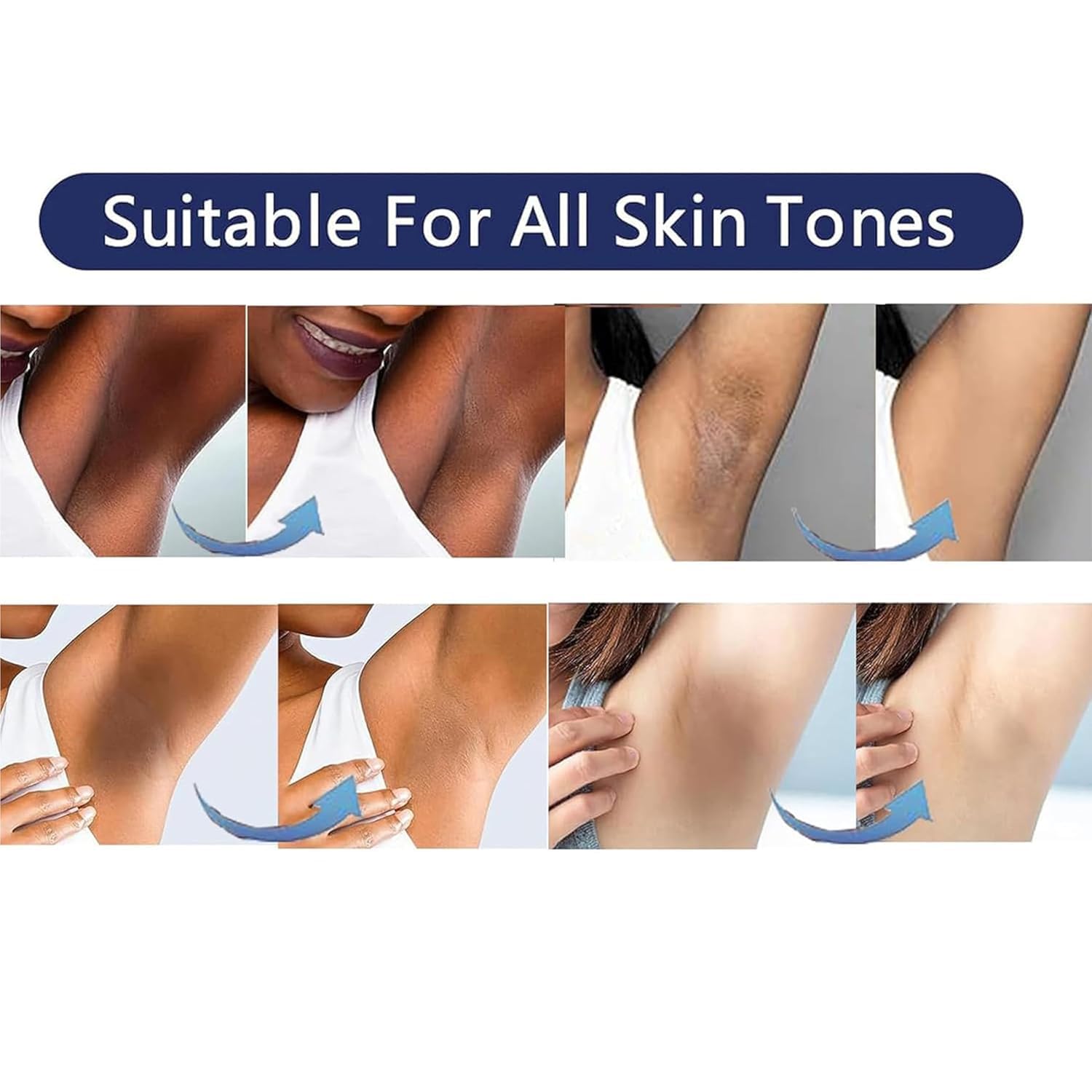 Vcetree Skin Bleaching Cream Skin Lightening for Body Intimate Areas, Private Parts, Underarm, Knees, Elbows, Inner Thigh, Bikini Area - PrimeBioHealth - canada supplements