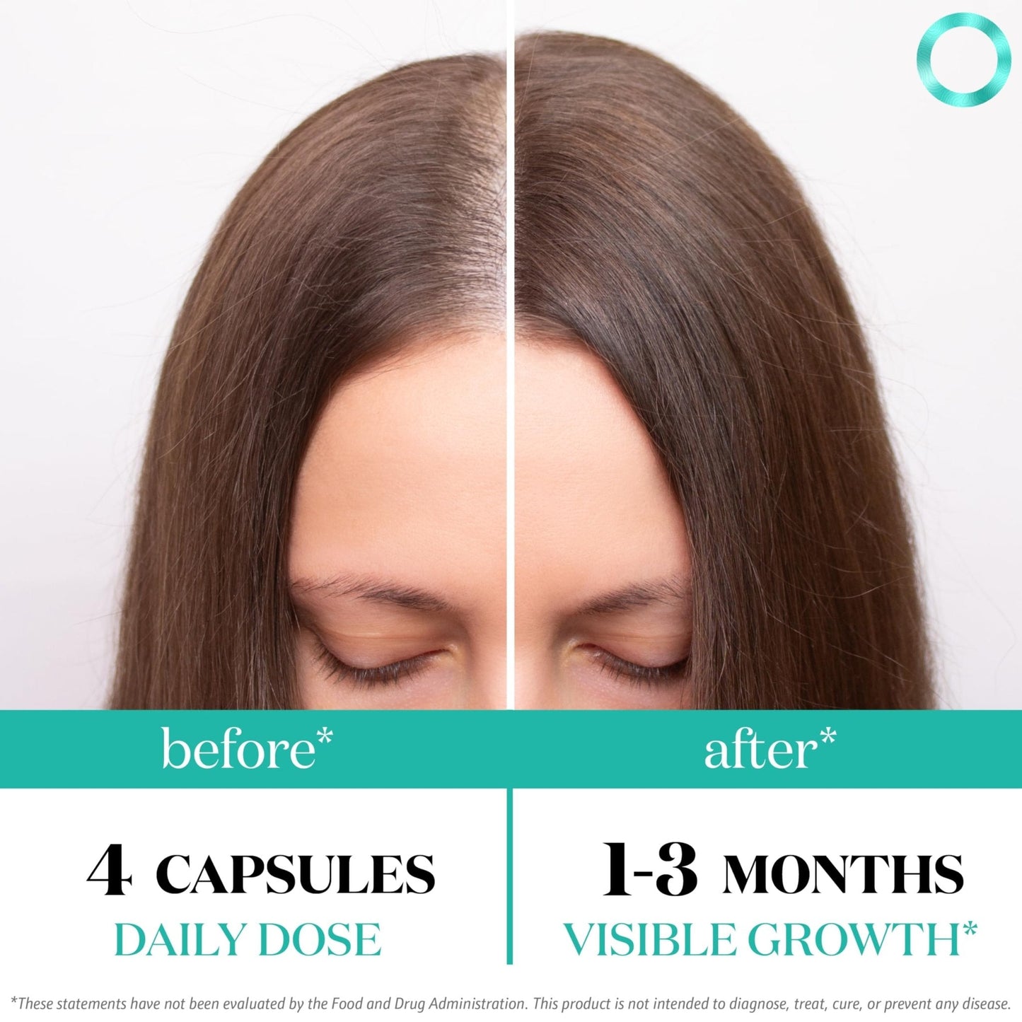 Women's Balance Hair Growth Supplements, Ages 45 and Up, Customer Proven for Visibly Thicker Hair and Scalp Coverage, Soy-Free, Made with 26 Ingredients including Beta Carotenes - 2 Month Supply - PrimeBioHealth - canada supplements